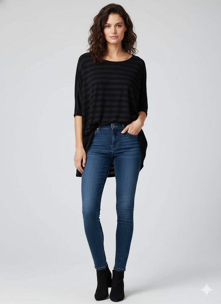 Alembika Striped Asymmetrical Tunic-ET413S